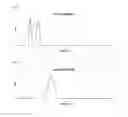 Fig. 03 - IMMUNOGENIC COMPOSITION COMPRISING ELEMENTS OF C. DIFFICILE CDTB AND/OR CDTA PROTEINS
