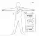 Fig. 01 - Systems and methods to reduce injury in the heart