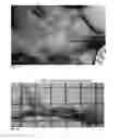 Fig. 02 - Neuromodulation device