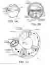 Fig. 02 - Hearing assistance device comprising an implantable part