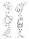 Fig. 09 - Patient aid devices, particularly for mobile upper extremity support in railed devices such as parallel bars and treadmills