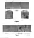 Fig. 04 - Ion-exchange membrane with multi-layered support substrate
