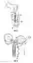 Fig. 04 - Pipette components useful for medical diagnostics