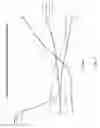 Fig. 18 - Magnetic filter systems and methods