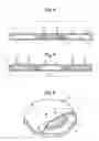 Fig. 04 - Cellular component concentrator and filter apparatus and method of use thereof