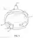 Fig. 05 - Re-Orientable Spray Foam Gun Nozzles