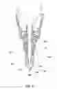Fig. 10 - Retractable nozzle for dosing or dispensing high viscosity materials