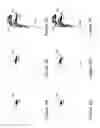 Fig. 04 - DELIVERY OF PARTICLES USING HYGROSCOPIC EXCIPIENTS