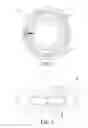 Fig. 02 - METHOD OF POWER TRANSMISSION TO CONTACT LENS AND SYSTEM USING THE SAME