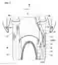 Fig. 04 - Saddle-riding-type vehicle sensor unit attachment structure