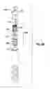 Fig. 10 - LIQUID CONTAINERS HAVING FILTERS AND RELATED METHODS