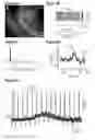 Fig. 06 - Minimally-invasive and activity-dependent control of excitable cells