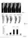 Fig. 02 - Anti-glucosaminidase passive immunization for infections