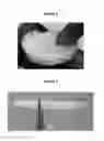 Fig. 02 - Biologically functional soft tissue scaffolds and implants