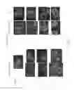 Fig. 15 - PRODUCTION OF INSULIN PRODUCING CELLS
