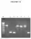 Fig. 02 - Methods, compositions, and kits for generating rRNA-depleted samples or isolating rRNA from samples