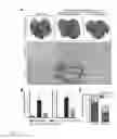Fig. 06 - APPLICATION OF SYK SERVING AS THERAPEUTIC TARGET FOR HEPATIC FIBROSIS/HEPATIC CIRRHOSIS