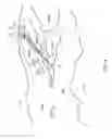 Fig. 03 - Aquatic curtain device and uses thereof