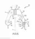 Fig. 06 - Rib mounting device with pivoting insert