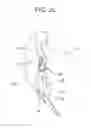 Fig. 06 - Device and method for locking a motor vehicle door closed in response to a side impact