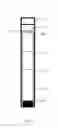 Fig. 07 - Methods and apparatus for collecting and preserving core samples from a reservoir