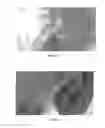 Fig. 08 - Modular active structural vibration suppression for wind turbine blades