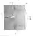 Fig. 06 - Centrifugal blood pump impeller and flow path