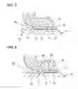 Fig. 06 - Sealed bearing assembly