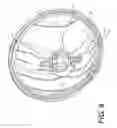 Fig. 09 - Bi-optic headlight assembly and lens of bi-optic headlight assembly