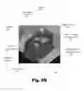 Fig. 05 - Systems and methods for the inspection of contact lenses
