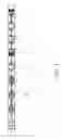 Fig. 02 - Magnetizers for pigging tools