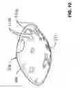 Fig. 11 - SEALING ASSEMBLY AND PLUG FOR NON-DESTRUCTIVE INSPECTION