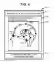 Fig. 07 - MEDICAL IMAGE IMAGING DEVICE FOR POSITIONING AN IMAGING SLICE