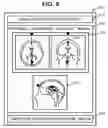 Fig. 09 - MEDICAL IMAGE IMAGING DEVICE FOR POSITIONING AN IMAGING SLICE