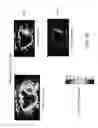 Fig. 17 - MRI method for determining signature indices of an observed tissue from signal patterns obtained by motion-probing pulsed gradient MRI