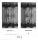 Fig. 10 - Liquid crystal display having a plurality of pixel electrodes in one pixel region