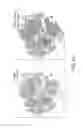 Fig. 22 - ANALYZING HIGH DIMENSIONAL SINGLE CELL DATA USING THE T-DISTRIBUTED STOCHASTIC NEIGHBOR EMBEDDING ALGORITHM