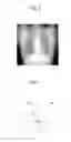 Fig. 04 - Radiographic image processing device, method, and recording medium