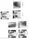 Fig. 02 - CHEST RADIOGRAPH (CXR) IMAGE ANALYSIS