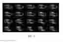 Fig. 05 - Multi-Spectral Three Dimensional Imaging System and Method