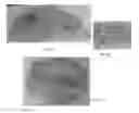 Fig. 06 - Multi-Spectral Three Dimensional Imaging System and Method