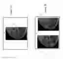 Fig. 06 - System and method for navigating a tomosynthesis stack using synthesized image data