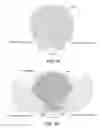 Fig. 09 - Differentially pumped reactive gas injector