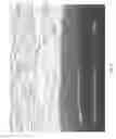 Fig. 06 - Rechargeable battery with wafer current collector and assembly method