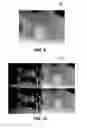 Fig. 13 - Tiling in video encoding and decoding