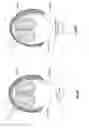 Fig. 34 - Body impact protection system