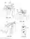 Fig. 06 - Stowable apparel item