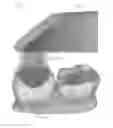 Fig. 03 - Detection of a movable object when 3D scanning a rigid object