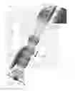 Fig. 04 - Detection of a movable object when 3D scanning a rigid object