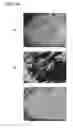 Fig. 09 - Endoscope apparatus